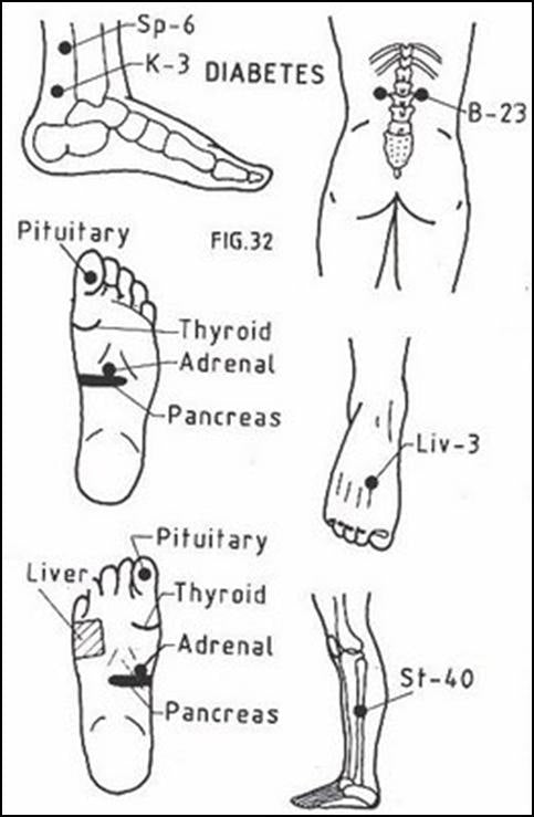 reflexology-in-diabetes