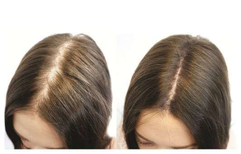 biotina capelli benefici crescita