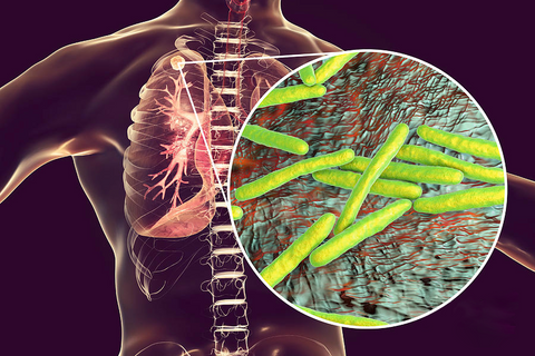 Cordyceps Sinensis Extract - Lung Clearing Drops