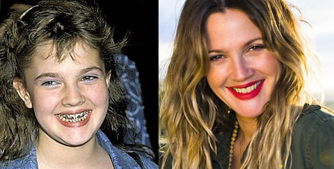 Drew Barrymore braces