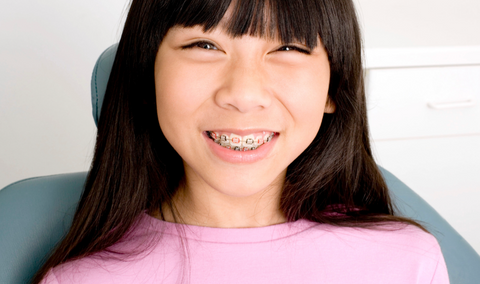 children braces