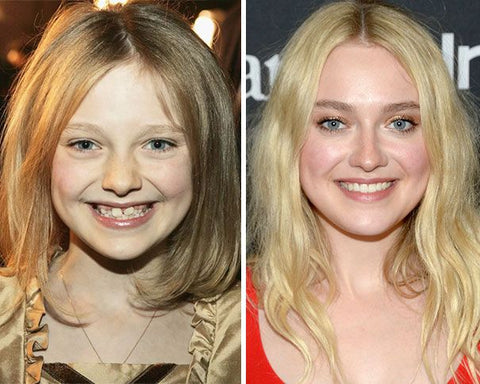 Dakota Fanning with braces