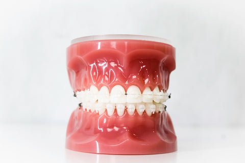 Do Ceramic braces turn yellow? | Northenden House Orthodontics