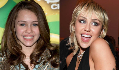 miley cyrus with braces