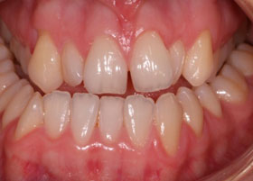 Orthognathic Case Studies | Manchester Orthodontics