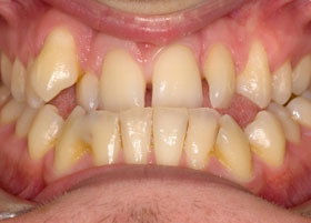 Orthognathic Case Studies | Manchester Orthodontics