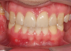 Orthognathic case studies | Manchester Orthodontics