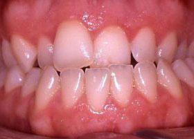 Orthognathic case studies | Manchester Orthodontics