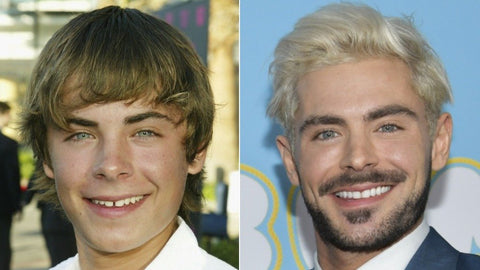 24 Celebrities Who Had Braces