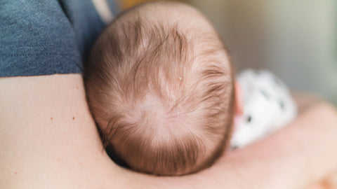 cradle cap