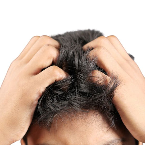 Stress can lead to flare-ups of seborrheic dermatitis