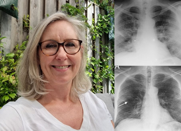 Oveallgo® Breatheora Mullein Lung Purifier
