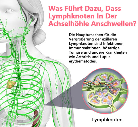 geschwollene Lymphknoten im Nacken