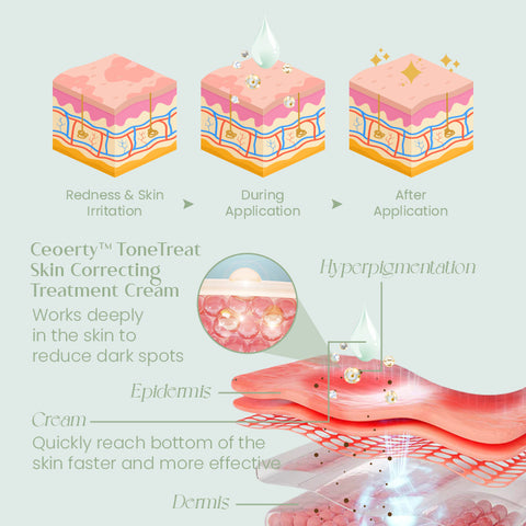 Ceoerty™ ToneTreat Skin Correcting Treatment Cream