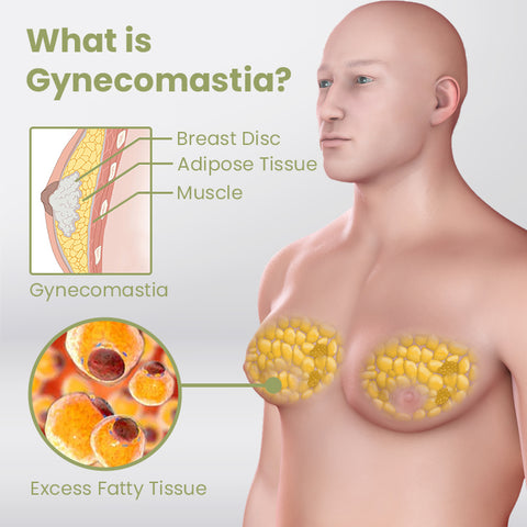 Ceoerty™ GynoCare TurmeMAX Compress Patch