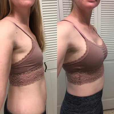 Ceoerty™ BosomUp Breast Enhancement Patch