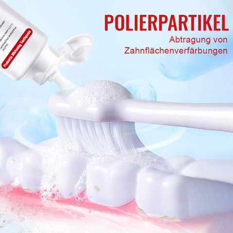 SmileMate™ SP-4TM Probiotische Whitening-Zahnpasta
