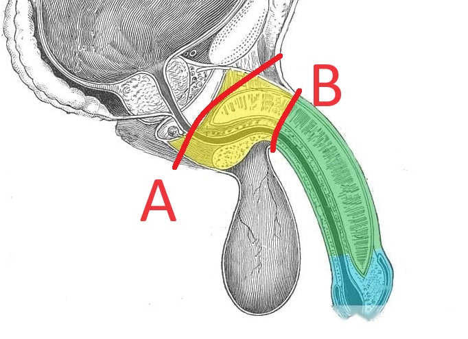 Penis Pump Cock Ring Placement Following Session for Maximum Enlargement