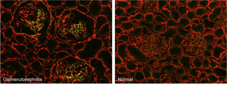 Micrographs of kidney cryosections stained with fluorescent F-CHP