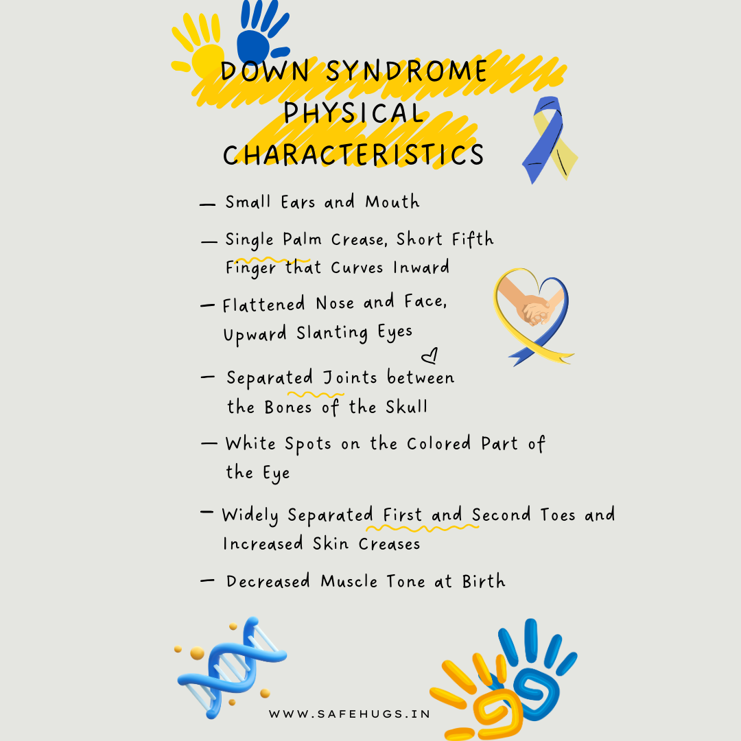 Down Syndrome physical characteristics.