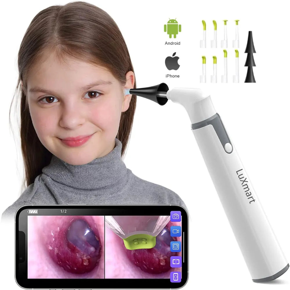 Ear Camera Endoscope Wireless Otoscope WiFi Technology