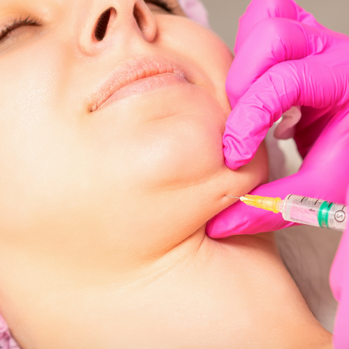 Lemon Bottle Fat Dissolving Injections Pembrokeshire, South Wales