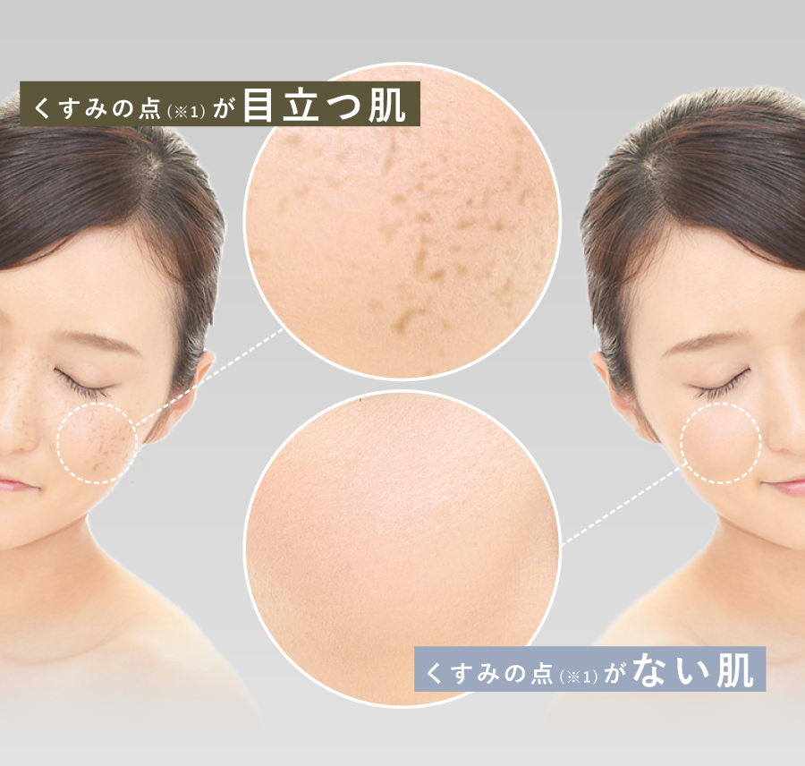 くすみの点が目立つ肌 くすみの点がない肌
