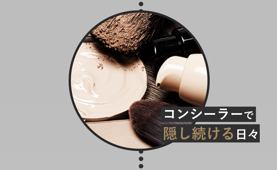 コンシーラーで隠し続ける日々