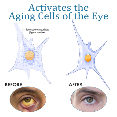 ATTDX Treatment EyeProblems SolutionDrops