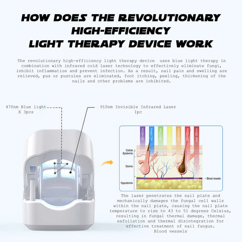 Oveallgo™ NailFungal CleaningLaser TherapeuticDevice
