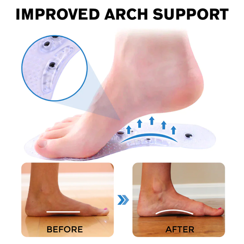 Ricpind MagneticTherapy SwellReduce Acupressure Insoles