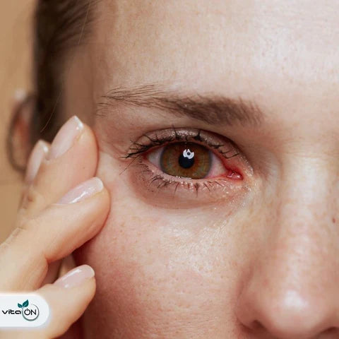 Was sind trockene Augen und was ist das Syndrom des trockenen Auges?