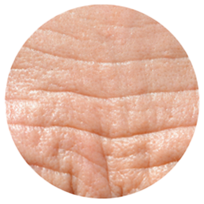 Close-up of wrinkled skin texture in a circular frame.