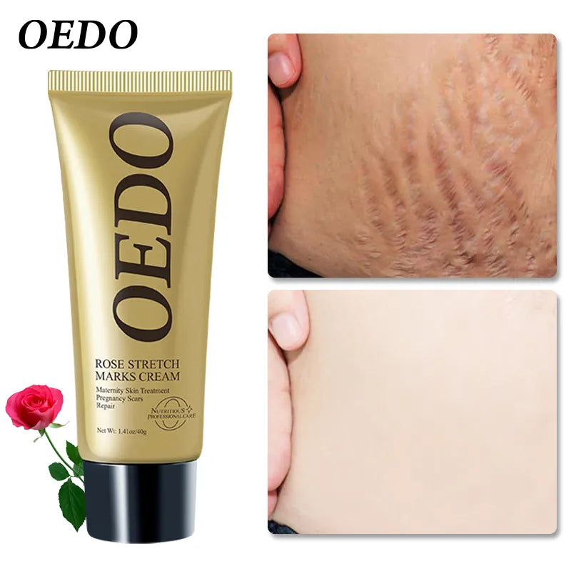 Rose Removes Stretch Mark Cream