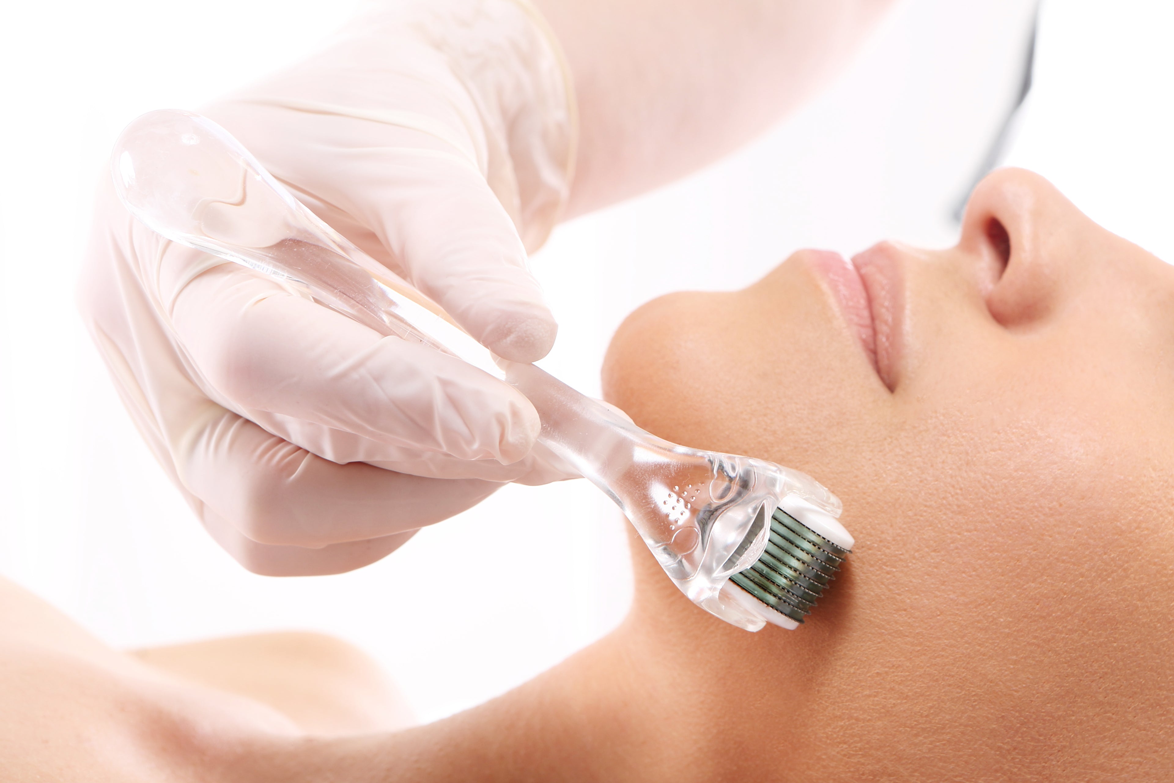 A woman doing a micro-needling with a dermaroller.