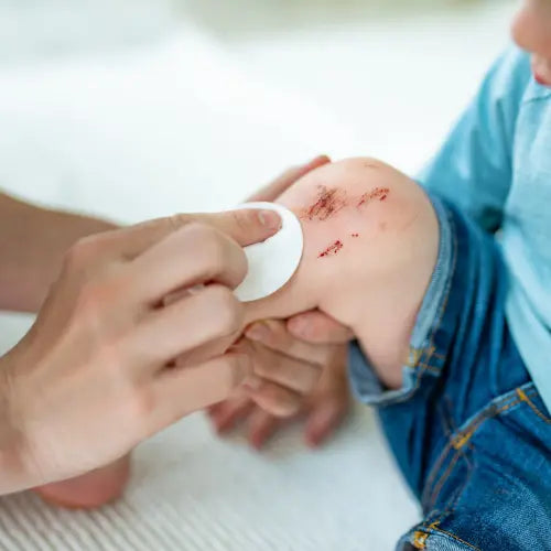 Main d'une femme qui soigne le genou érafler d'un petit garçon