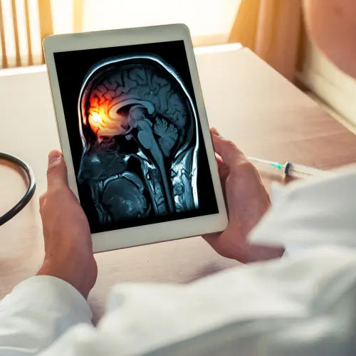 Irm du cerveau sur une tablette avec une zone rouge illustrant la douleur