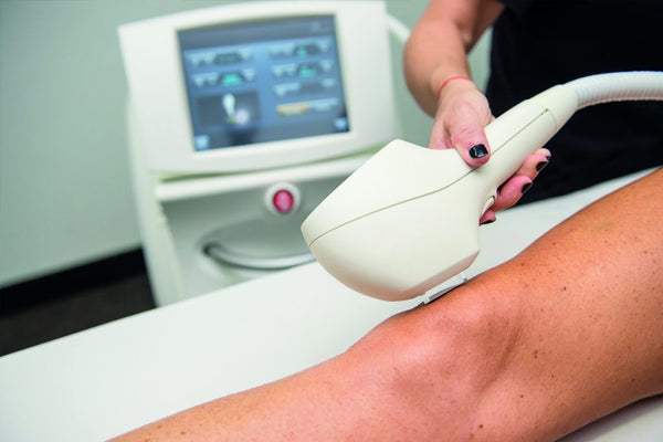 IPL hair removal élimination permanente poils