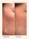 A before and after comparison of someone using Travel Size Glass Skin Refining Serum, where the after image clearly shows that their skin looks smoother and dark spots appear visibly brighter for easier blending with the skin tone