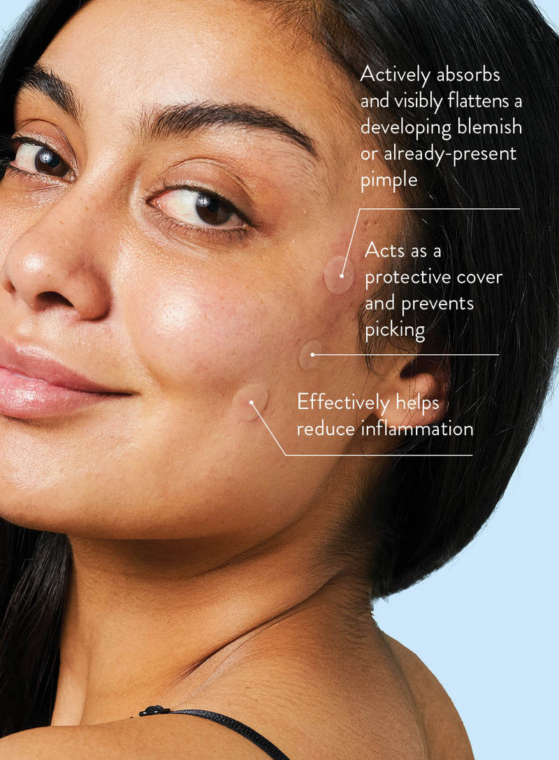 An elegant, middle-aged woman wears three Peach Slices Acne Spot Dots with highlights pointing to each patch with highlights such as how they actively absorb and flatten developing blemishes or already-present pimples, act as protective covers and prevent picking, and effectively help reduce inflammation