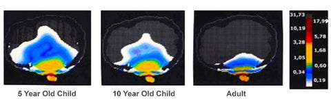 子供の放射線吸収