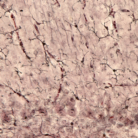 microglial cell stain image