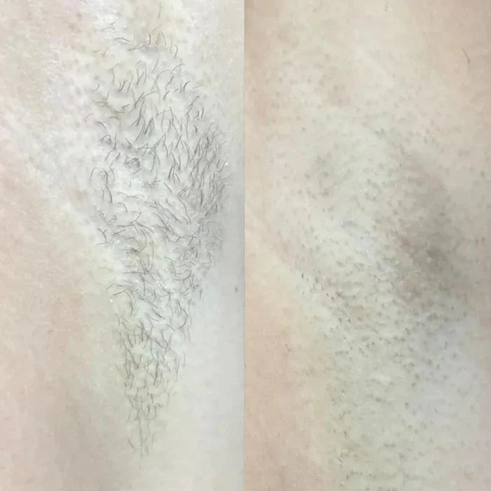 Close-up comparison of skin with hair in two different conditions.