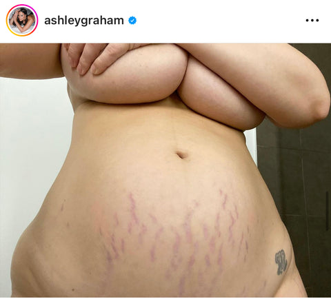 ashley graham affiche son postpartum