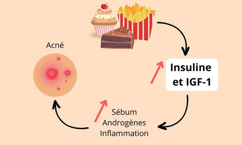 insuline fast food glycemie acné