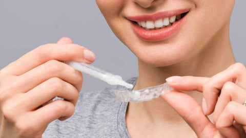 Un kit de blanqueamiento dental puede tener muchas características