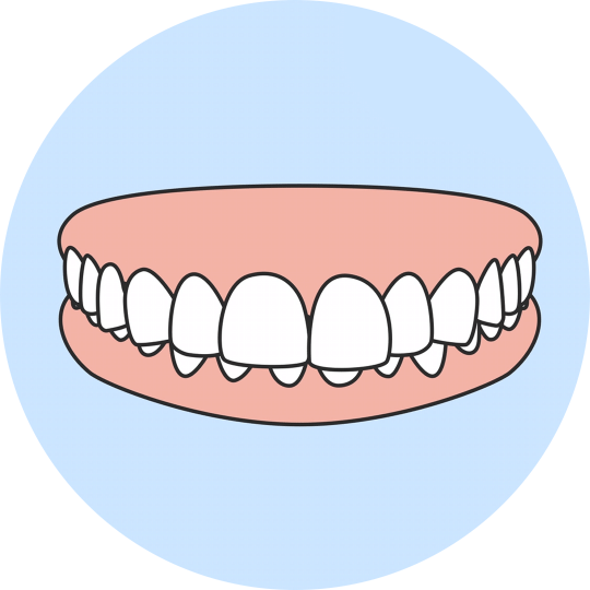 Transform Your Smile with Overbite Correction