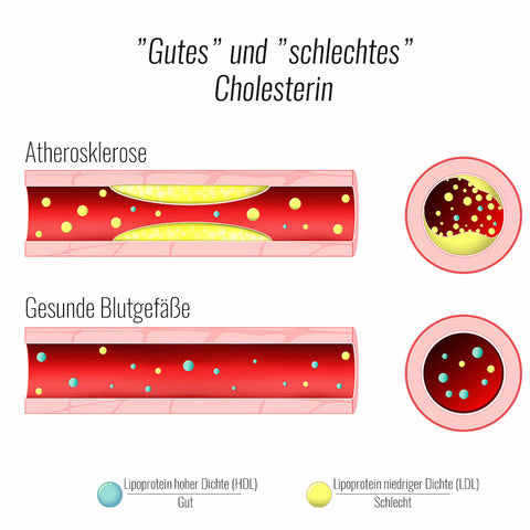 Eier Cholesterin