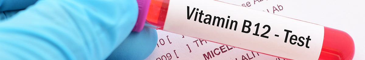 Vitamin B12 test