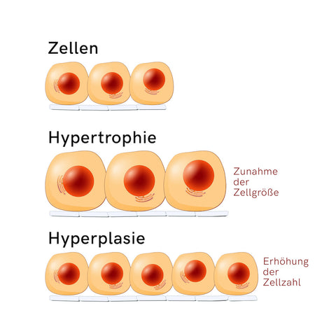 hypertrophietraining